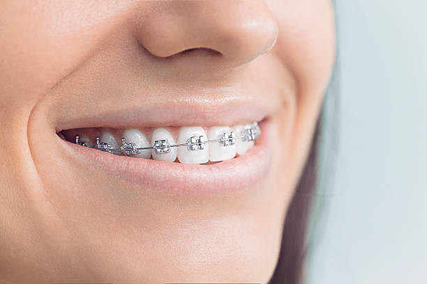 Best Tooth Extraction  in Syracuse, IN